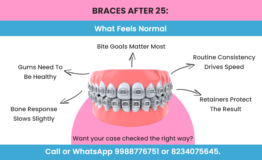 braces after 25 factors to be considered before the treatment