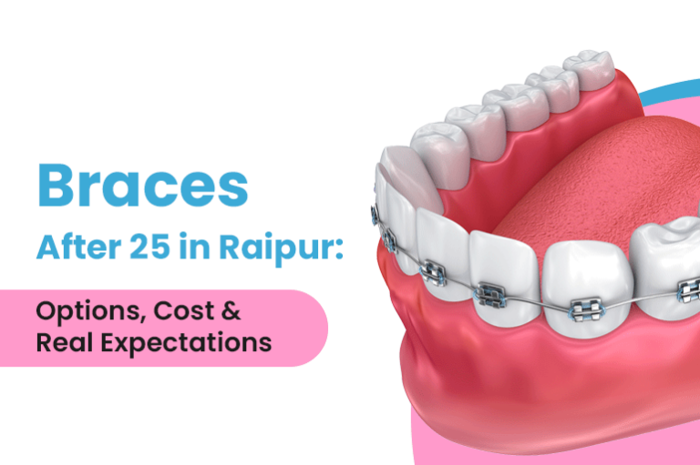Braces After 25 in Raipur: Options, Cost & Real Expectations