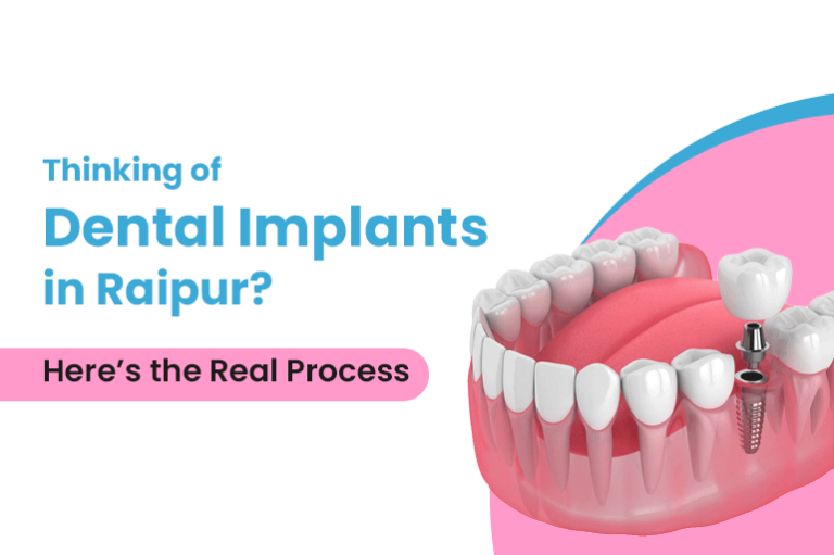 Thinking of Dental Implants in Raipur? Here’s the Real Process