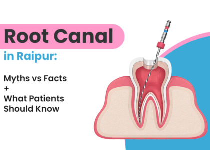 root canal in raipur: myths vs facts + what patients should know