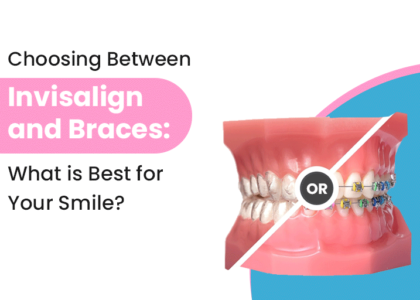 Choosing between Invisalign and braces in Raipur — comparison guide, 32 Pearls Dental Clinic