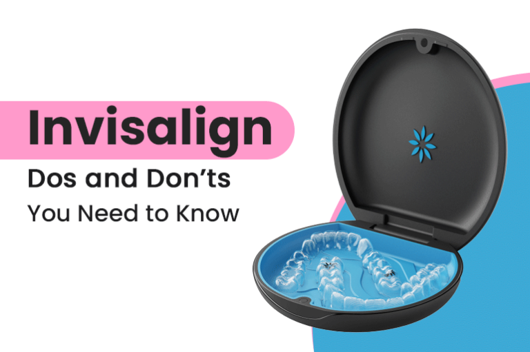 Invisalign Dos and Don’ts You Need to Know