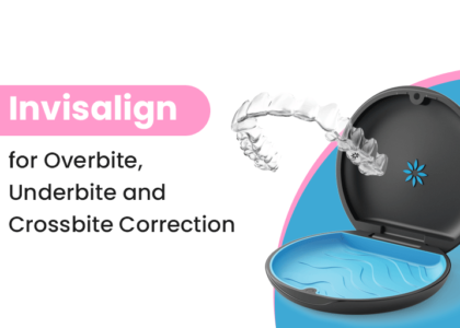 Graphic explaining how Invisalign aligners correct overbite, underbite and crossbite