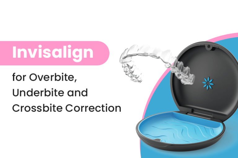Invisalign for Overbite, Underbite and Crossbite Correction