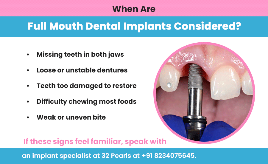 dental implants in raipur